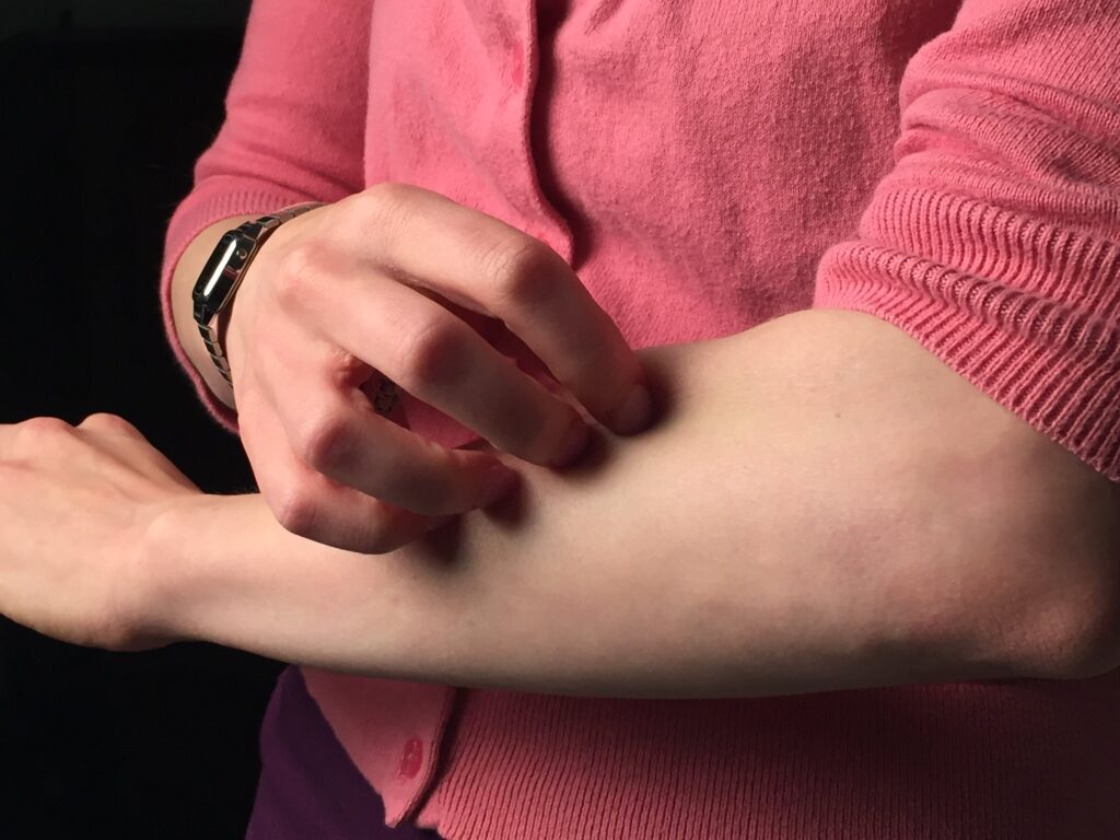 Microbiota e dermatite